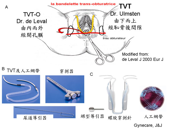 手護之愛台灣腦中風病友協會